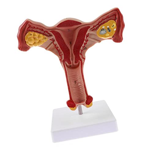 Oikabio 1: 1 Menschliche Weibliche GebäRmutter Eierstock Eileiter Modell Anatomisches Menschliches Anatomiemodell Lehrmittel