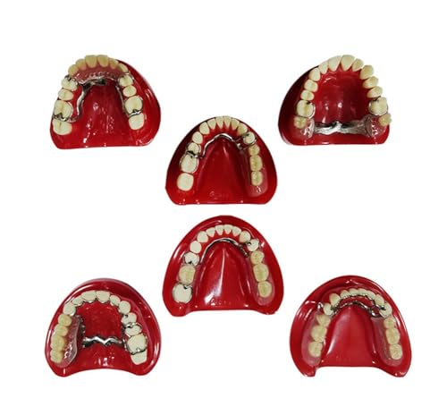 Zahnärztliche Modelle für den mündlichen Unterricht, vollständige Mundproben verschiedener Defektzustände, Modelle für zahnmedizinische Defekte