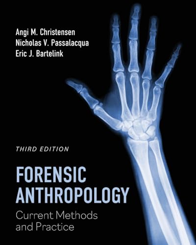 Forensic Anthropology: Current Methods and Practice