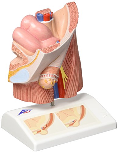 3B Scientific menschliche Anatomie - Leistenbruchmodell - 3B Smart Anatomy