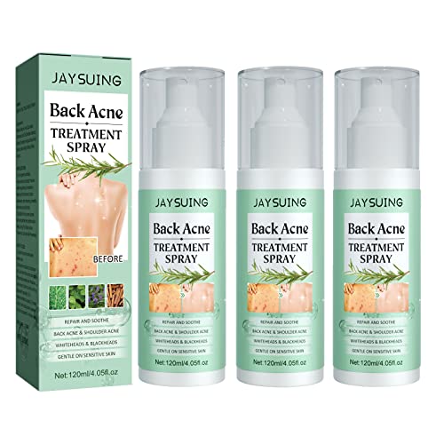 Toxiklenz Back Acne Treatment Spray, Acne Spray Back and Chest Acne Treatment, DerMist Rücken Akne Behandlung Kräuterspray, Gentle on Skin (3pc)