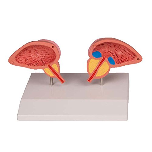 Anatomie Modell der Prostata, Prostata-Modell, anatomisches Modell, 2-teilig