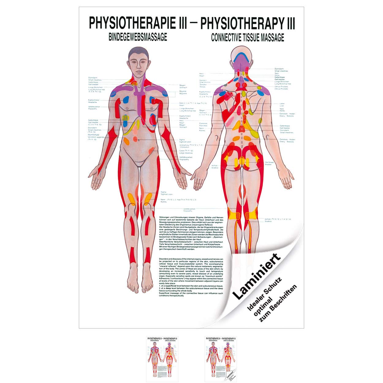 Rüdiger Bindegewebsmassage Poster Anatomie 70x50 cm medizinische Lehrmittel