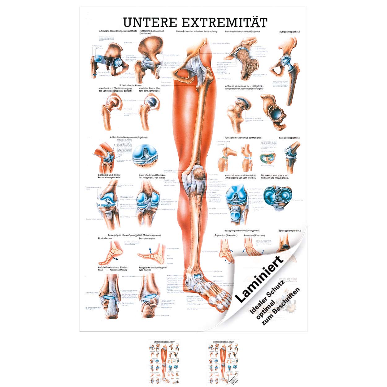 Rüdiger Untere Extremität Lehrtafel Anatomie 100x70 cm medizinische Lehrmittel