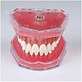 FMOGE Zahnimplantat Zahnmodell - Medizinische Wissenschaft Dental Education Model - Implantate Medical Restoration Model - Dental Demonstration Zahnmodell mit allen abnehmbaren Zähnen