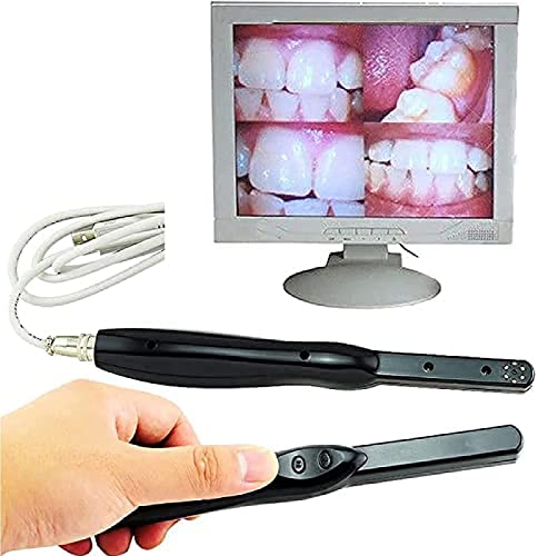 Dental Intraoral Camera, HD USBWireless Dental Intraoral Camera, 6 Megapixel, 6 LED Clear Image, Für Die Orale Untersuchung Von Personen Und Haustieren, Kieferorthopädische Zähne, Gesundheit Und K