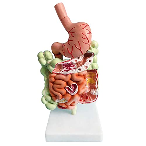 Nicfaky Menschliches Verdauungssystem Modell Magen Anatomie Darm Cecum Rektum Zwölffingerdarm Menschliche Innere Organe Strukturmodell
