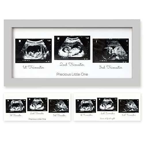 Sonogramm-Bilderrahmen – Trio Ultraschall-Bilderrahmen für werdende Mutter – Baby-Ultraschall-Rahmen – Schwangerschaftsankündigungen, Sonogramm-Rahmen – Baby-Kinderzimmer-Dekor, schwangere Mutter