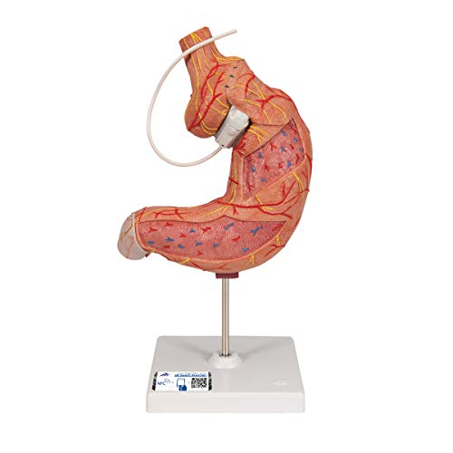 3B Scientific menschliche Anatomie - Magenbandmodell - 3B Smart Anatomy