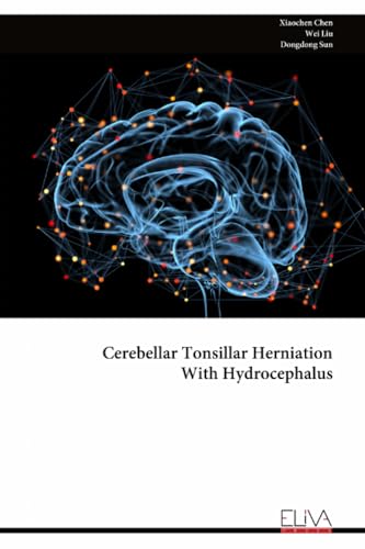 Cerebellar Tonsillar Herniation With Hydrocephalus
