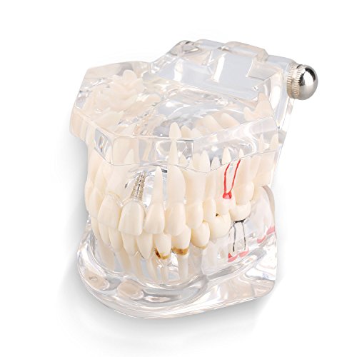 Zahnmedizinische Lehrstudie Erwachsene Typodont Demonstrationszähne Modell Neu