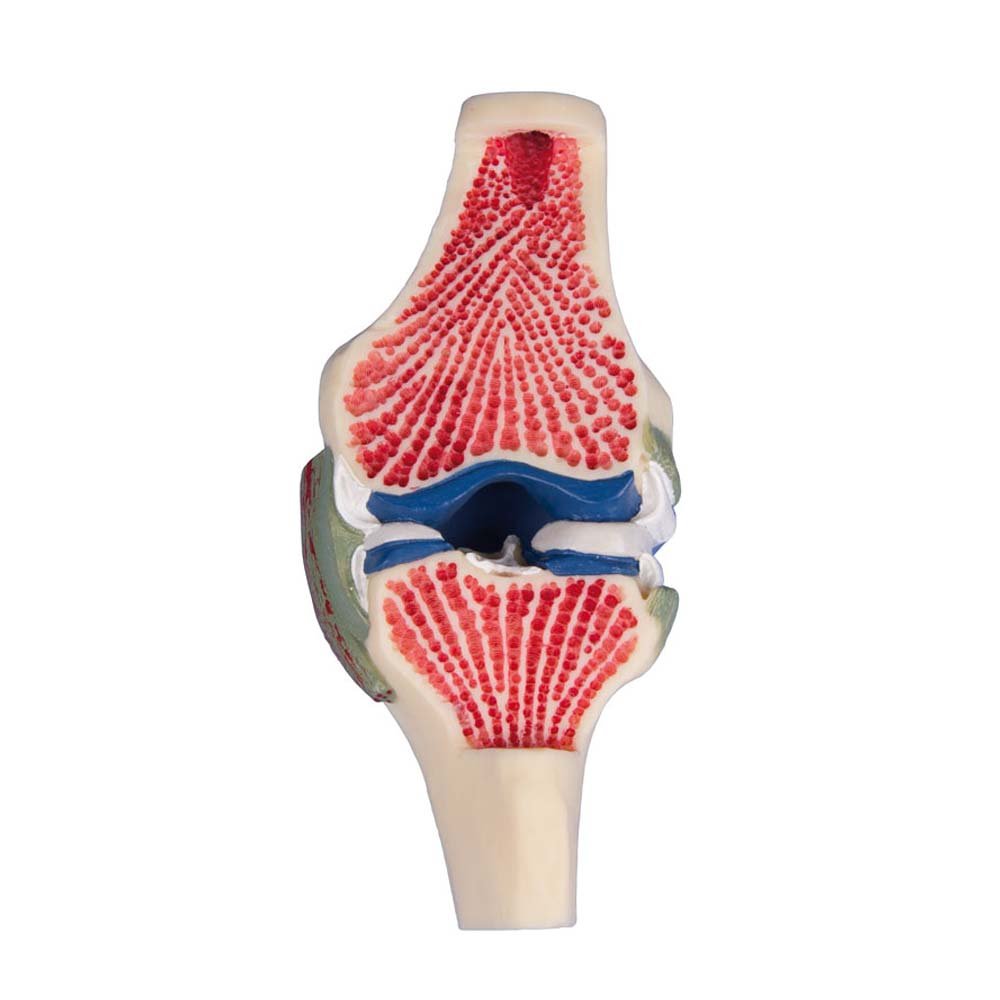 Anatomie Modell, Gelenkschnitt-Modell des Knies, lebensgroß, Kniegelenk-Modell
