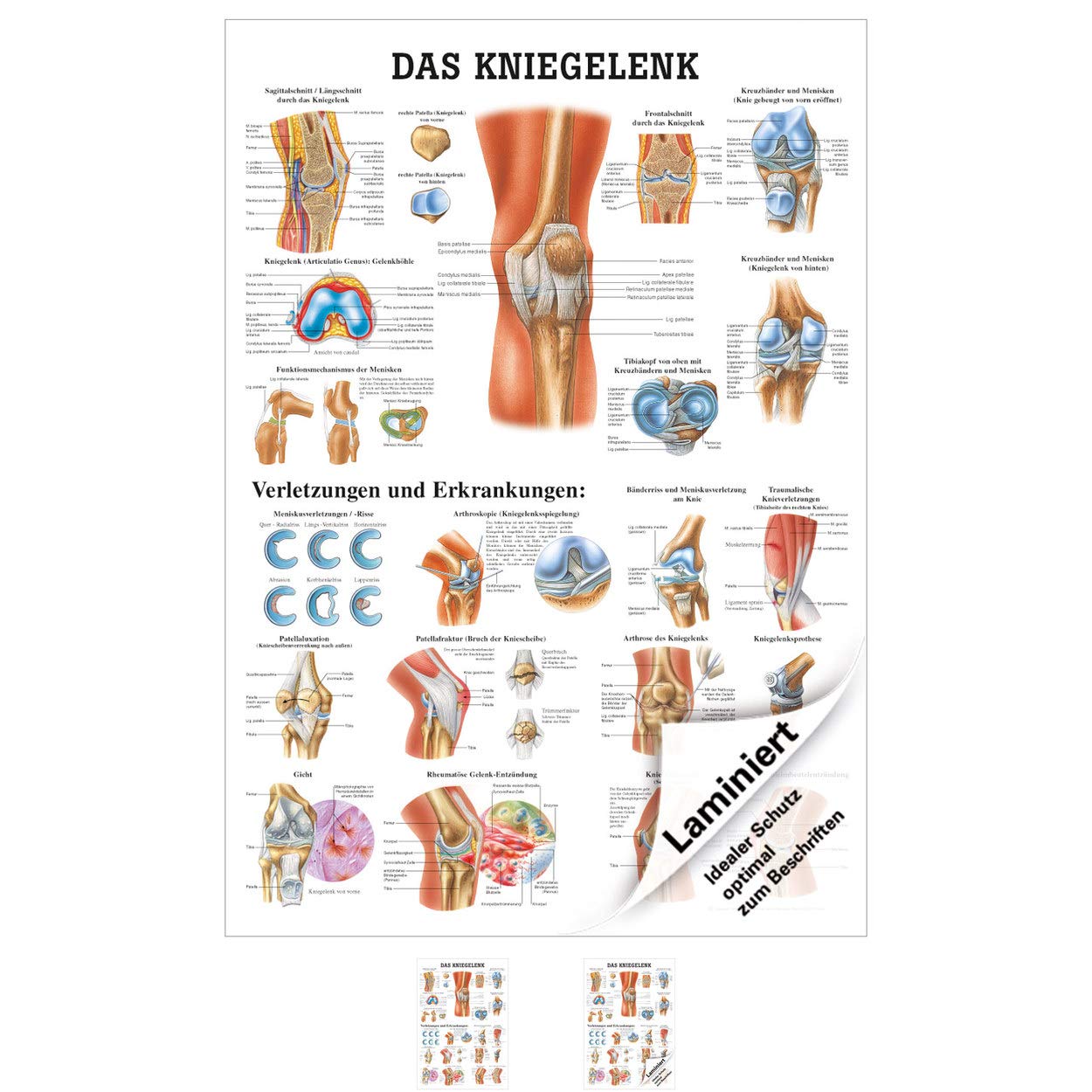 Rüdiger Das Kniegelenk Lehrtafel Anatomie 100x70 cm medizinische Lehrmittel