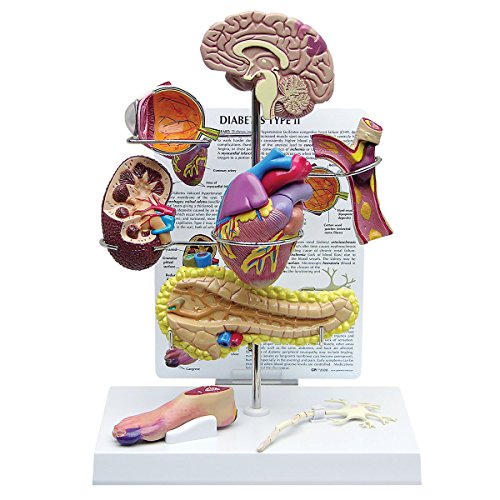 GPI Anatomicals W33386 Diabetes Modell, mini Set, 4 Stück