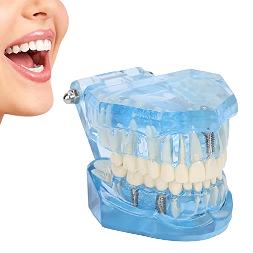FOLOSAFENAR Kinderzahnmodell, leichtes, praktisches Zahnmodell mit abnehmbaren Zähnen für Studenten für Labore für Lehrer für die Schule