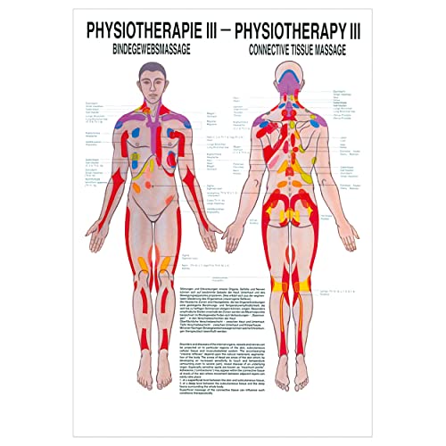 Bindegewebsmassage Poster Anatomie 70x50 cm medizinische Lehrmittel