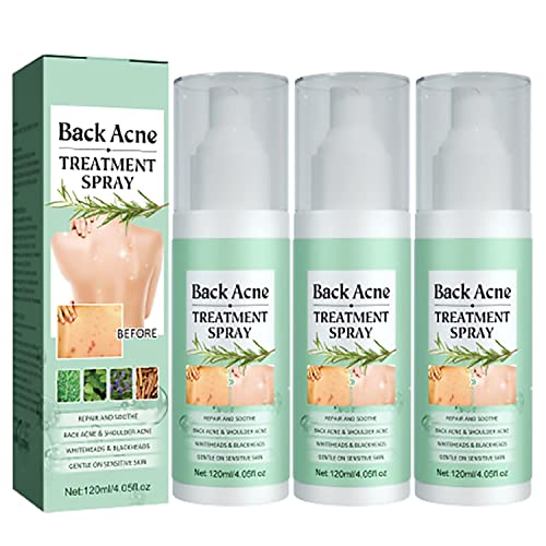 Toxiklenz Back Acne Treatment Spray, 2023 NewBack Acne Treatment Spray, Back Acne Treatment, Acne Spray Back and Chest, Spray for Back Acne, Gentle on Skin (5PCS)