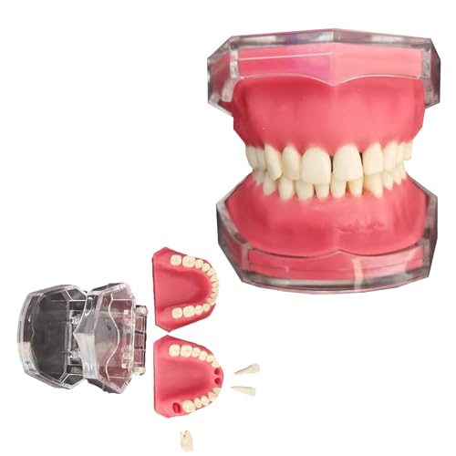 Dental-Extraktions-Modell, Vollmund-Harz-Zahnmodell, für Praxis, Kommunikation, Klinik, Ornamente, zahnmedizinische Lehrmittel