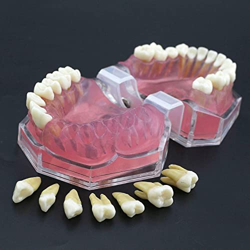 KUUY Zahnmodell Weiches Zahnfleisch Vollständige Demontage Lernübungen Zahnextraktion Vollständige Demontage Zahnmodell für die Zahnmedizin oder den Zahnarzt zur Kommunikation mit Patienten