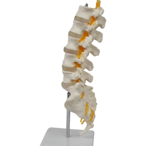 FIGGRITID Lehrgerätemodell 5-Segment-Lendenwirbelsäule mit Sakralzubehör Orthopädisches Lehrdisplay Lehrmittel
