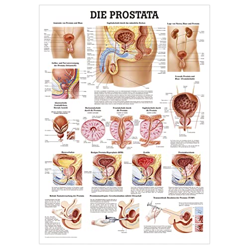 Rüdiger Die Prostata Lehrtafel Anatomie 100x70 cm medizinische Lehrmittel