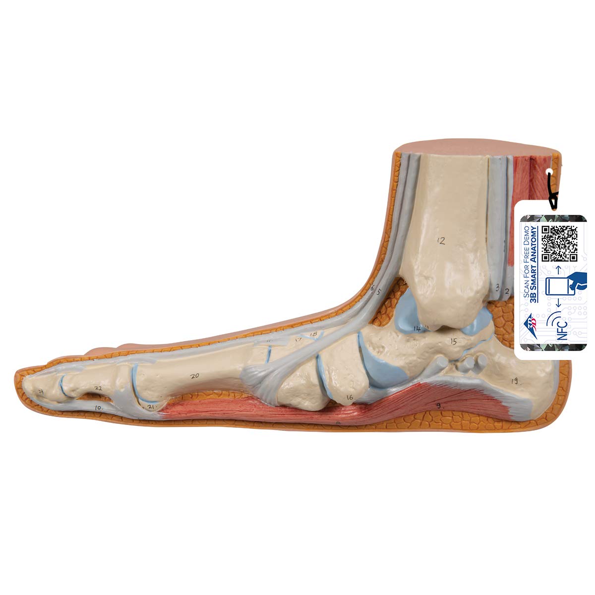 3B Scientific Menschliche Anatomie - Modell - Plattfuß (Pes planus) + kostenlose Anatomie App - 3B Smart Anatomy
