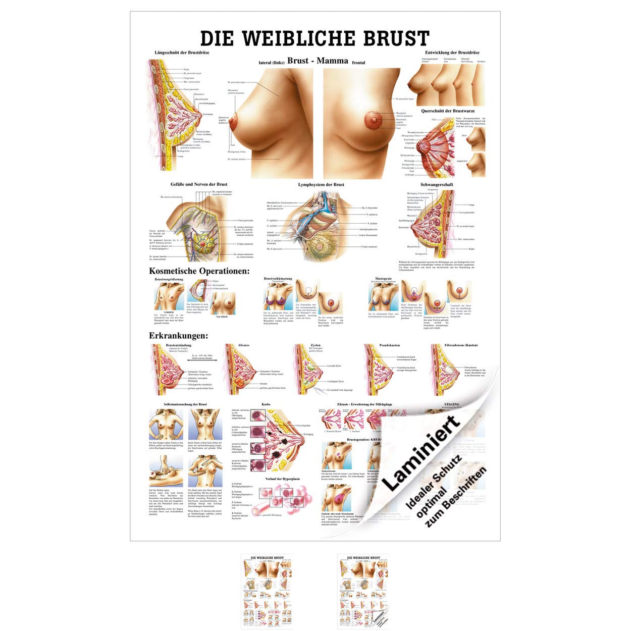 Weibliche Brust Lehrtafel Anatomie 100x70 cm medizinische Lehrmittel