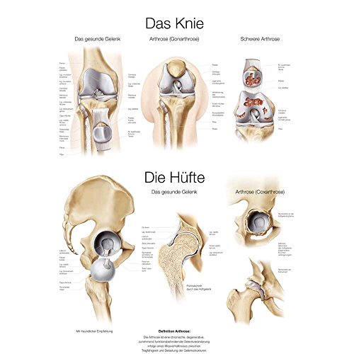 anatomische Lehrtafel"Das Knie/Die Hüfte" Anatomie Poster, 70x100cm