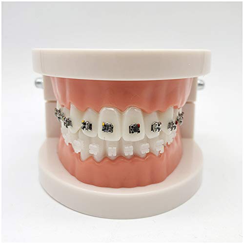 FHUILI Simulation Oral Tooth - Dental KFO-Demonstrationsmodell - Dental Teeth Studie Lehre Modell - Behandlung Modell mit Metallhalterung, Bogen Draht Erklären Modell mit Klammern,A