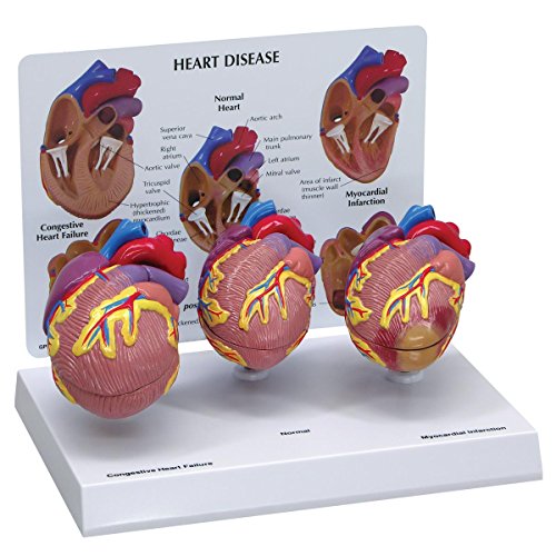 GPI Anatomicals W33365 Herz Modell mini Set