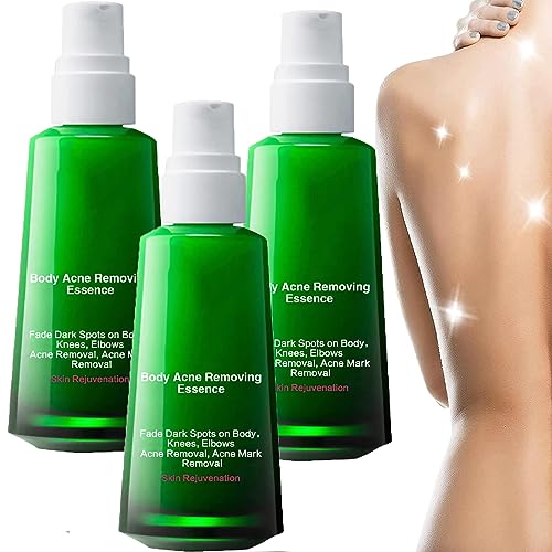 Jusbj Lightenu Body Acne Serum For Acne & Spots & Acanthosis Nigricans Removal, Lighten Up Body Acne Serum, Targets Body Acne & Prevents Future Breakouts (3PCS)