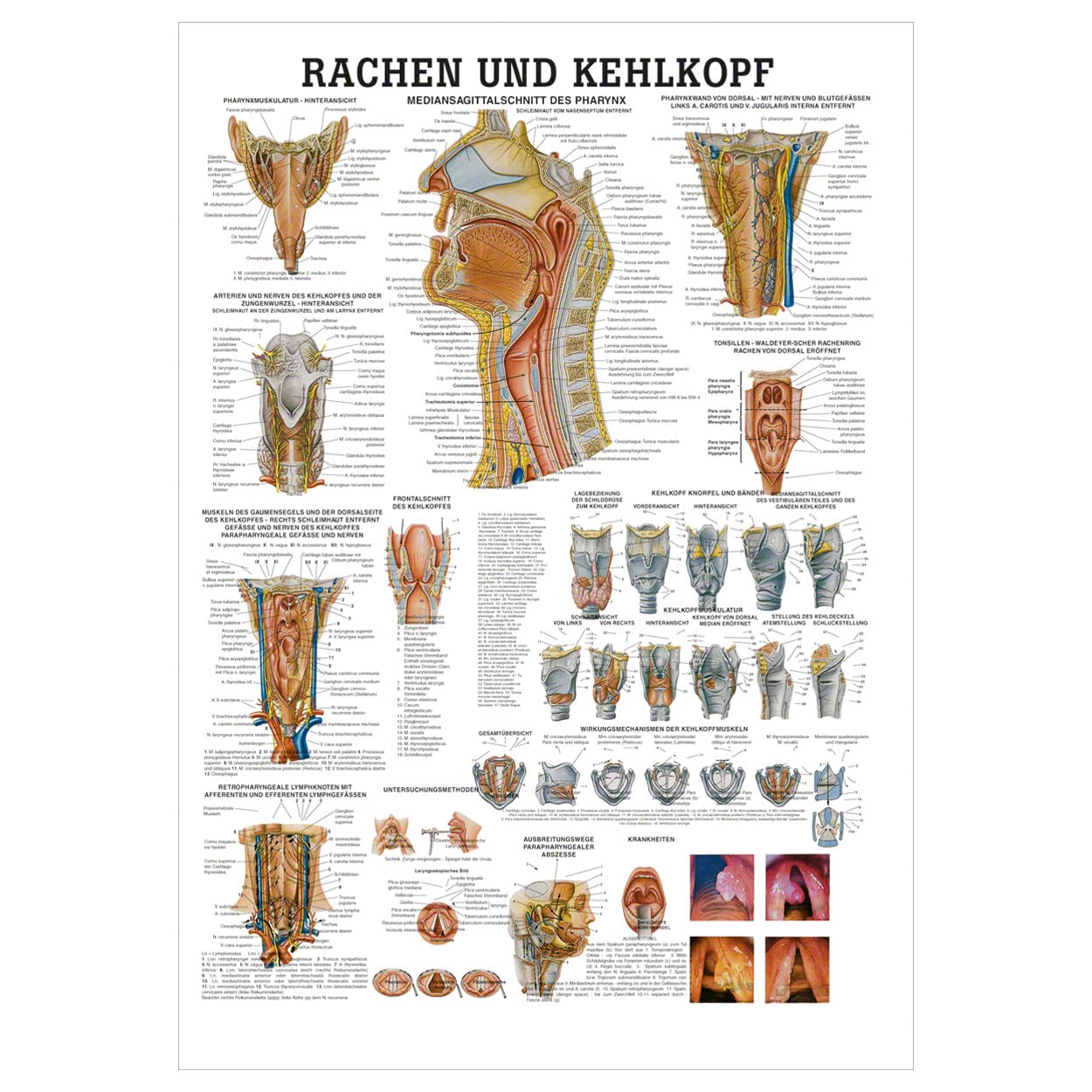 Rüdiger Rachen und Kehlkopf Lehrtafel Anatomie 100x70 cm medizinische Lehrmittel
