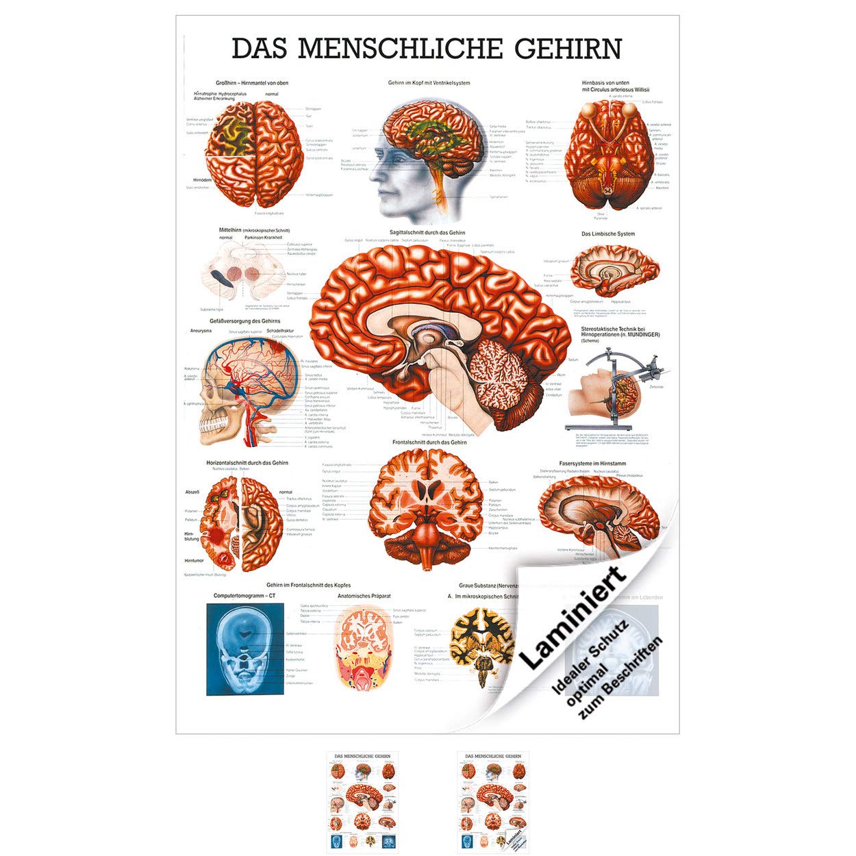 Rüdiger Das gehirn Lehrtafel Anatomie 100x70 cm medizinische Lehrmittel