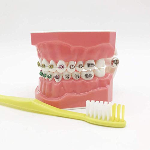 Zähne Modell Für Ausbildung - KFO-Modell - Zähne Lehr-Modell Mit Metall Und Keramik Bracket - Zähne Modell Korrektive Trainingsmodell Für Kinder Oral Care Lehre,A