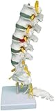 mkdental anatomischen menschlichen Wirbelsäule Modell besteht aus 5 Lendenwirbeln mit Bandscheiben Lendenwirbelsäule Nerven und Rückenmark