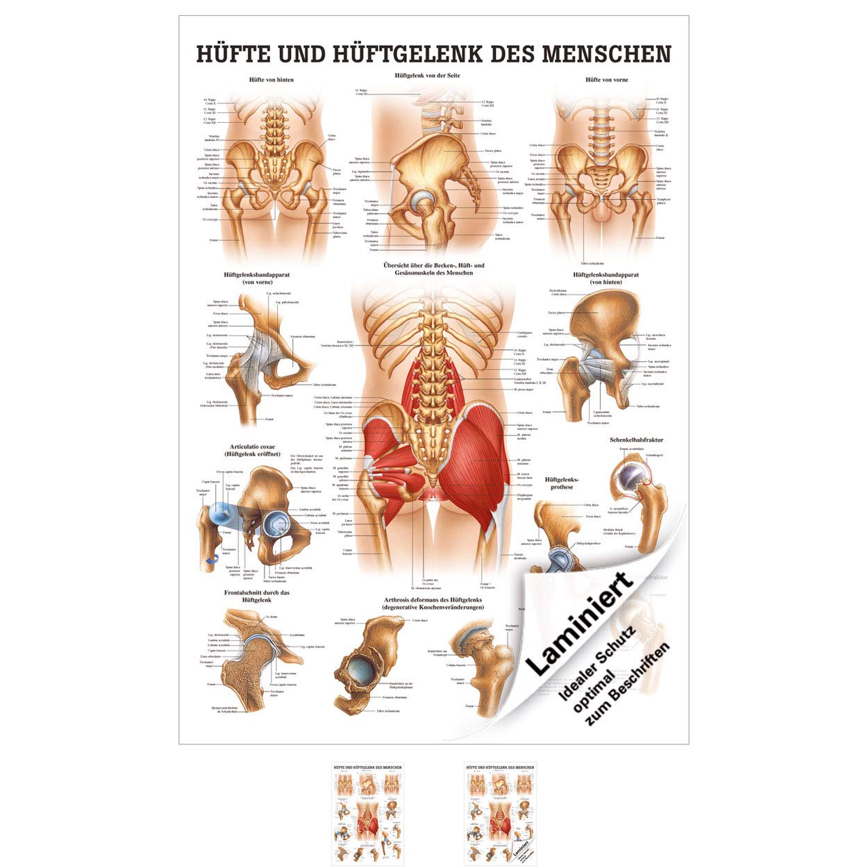 Rüdiger Hüfte und Hüftgelenk Lehrtafel Anatomie 100x70 cm medizinische Lehrmittel