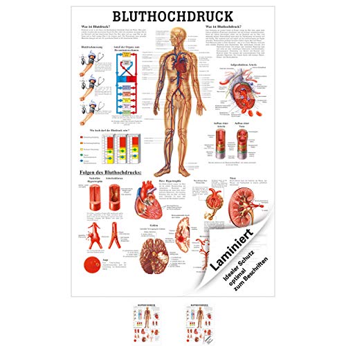 Bluthochdruck Poster Anatomie 70x50 cm medizinische Lehrmittel