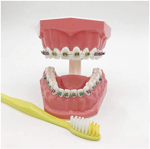 FHUILI Zähne Modell für Ausbildung - KFO-Modell - Zähne Lehr-Modell mit Metall und Keramik Bracket - Zähne Modell Korrektive Trainingsmodell für Kinder Oral Care Lehre,A