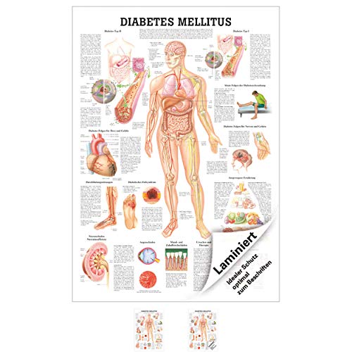 Ruediger Anatomie TA78LAM Diabetes mellitus Tafel, 70 cm x 100 cm, laminiert