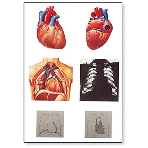 3B Scientific V2053M Lehrtafel, Das Herz I, Anatomie