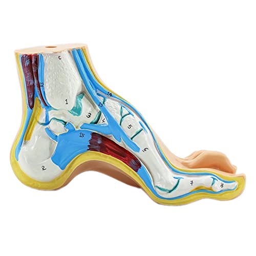 Human Foot Modell Fußmuskulatur Normaler Fuß Plattfuß Bogenfuß Modell Fuß Muskel Anatomie Modell Medizinische Wissenschaft Lehrmodell (C:Bogenfuß)