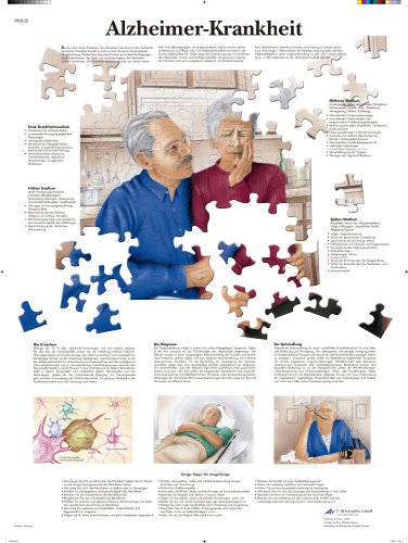 3B Scientific Lehrtafel laminiert - Alzheimer-Krankheit