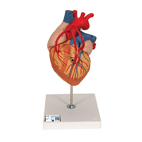3B Scientific menschliche Anatomie - Herz mit Bypass, 2-fache Größe, 4-Teilig - 3B Smart Anatomy