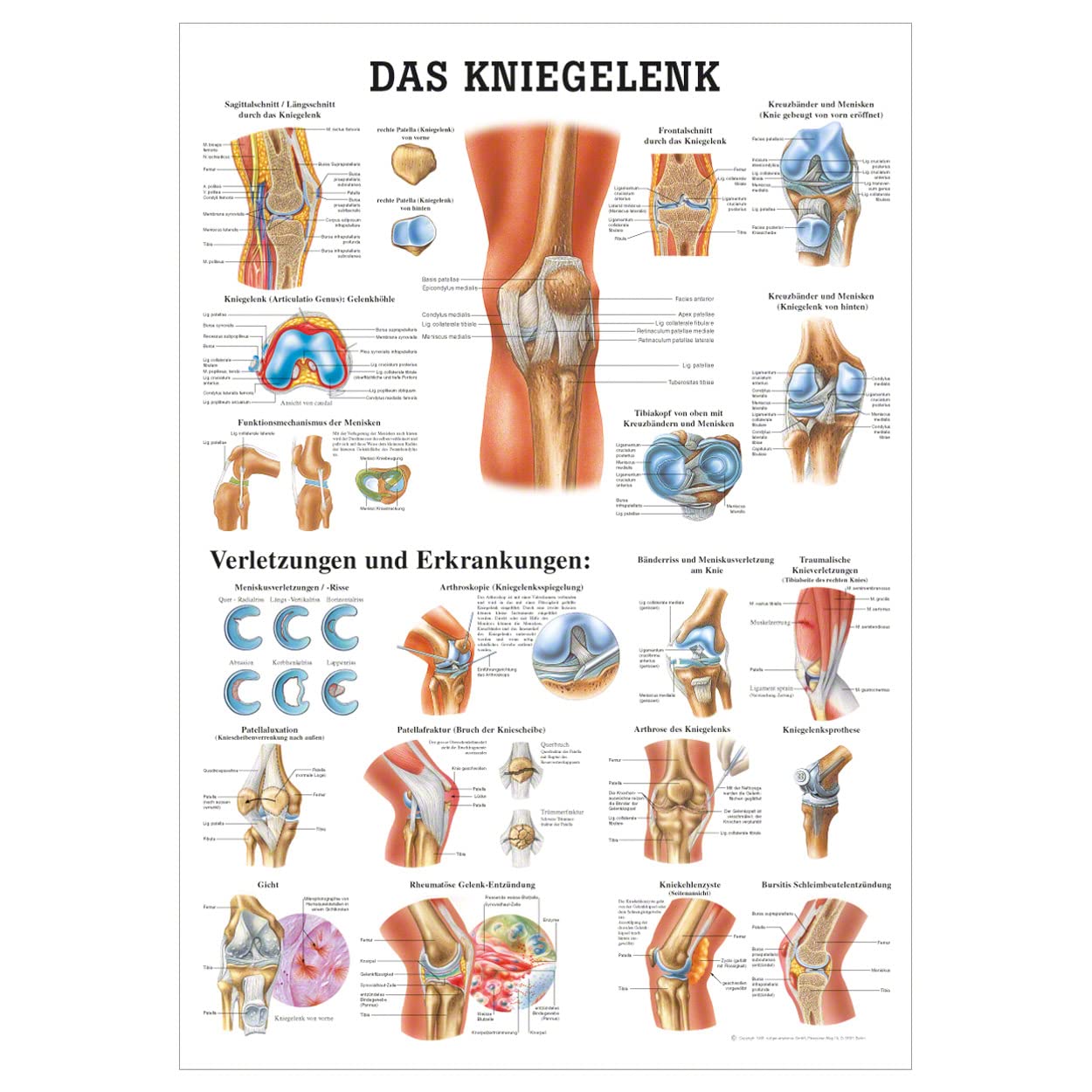 Rüdiger Das Kniegelenk Lehrtisch Anatomie 100x70 cm medizinische Lehrmittel