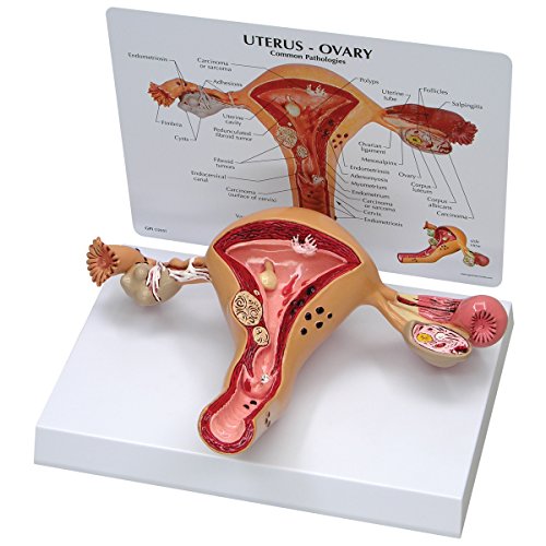 GPI Anatomicals W33352 Uterus Modell