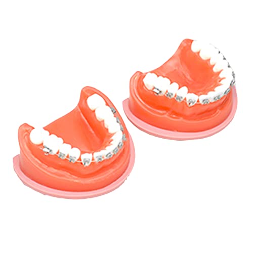 Typhoon Zahnmodell – pädagogisches Modell für kieferorthopädische Zähne – simuliertes Oralzahn-Lehrmodell – für Wissenschaftsunterricht, Forschungsdisplay, Laborbedarf (A)