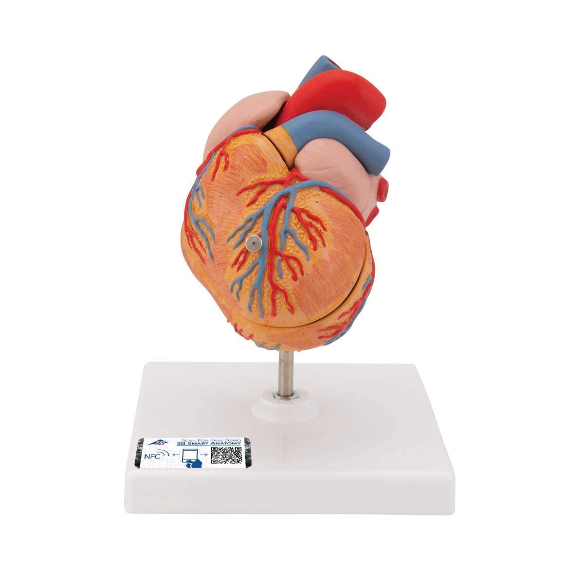 3B Scientific Menschliche Anatomie - Klassik-Herzmodell mit linksventrikulärer Hypertrophie (LVH), 2-teilig + kostenlose Anatomie App - 3B Smart Anatomy, G04