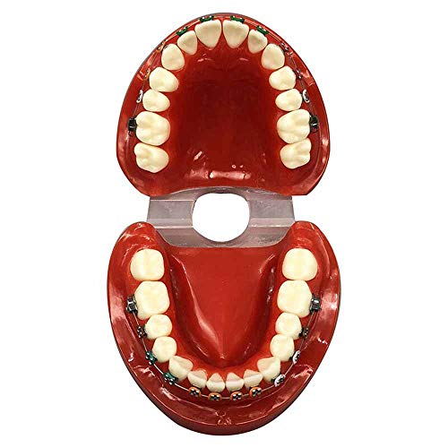 FHUILI Zähne Teaching Model - KFO Zähne Modell - Zähne Vorführmodell - Dental Typodont mit Mental Brackets KFO Zähne Modell mit Ligatur Krawatten Red,A