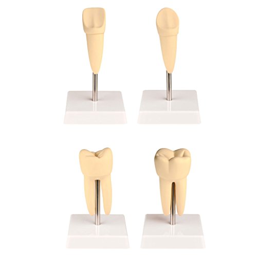 Zahnmodelle - Die vier Zahnarten im Vergleich - Schneidezahn, Eckzahn, Vormahlzahn und Mahlzahn | Wiemann Lehrmittel