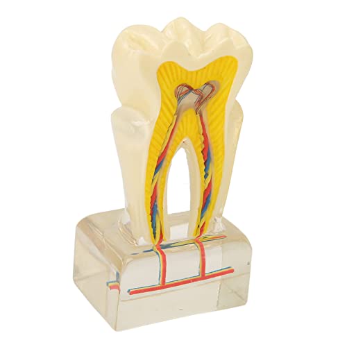 Zerfallene Zähne Modell Zahnarzt Sichere tragbare Acryl-Zahnarzt-Lehrhilfen